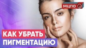 Как убрать пигментные пятна? Самый правильный и эффективный способ. Курсы МЦПО