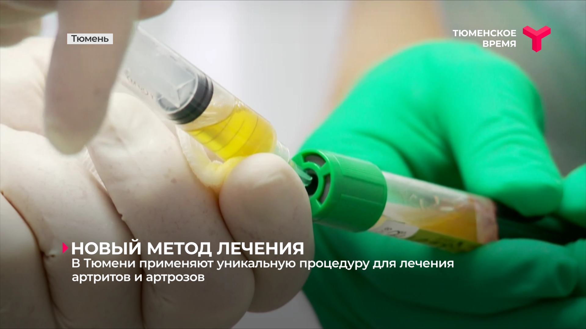 В Тюмени применяют уникальную процедуру для лечения артритов и артрозов
