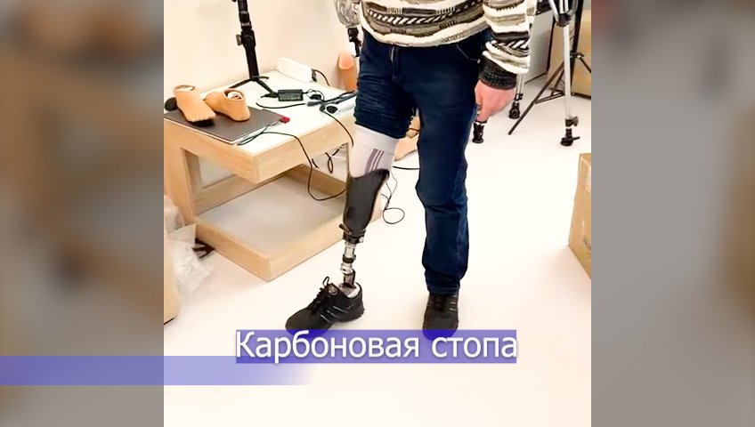 Протез голени: Новый легкий протез, мягкая стопа.