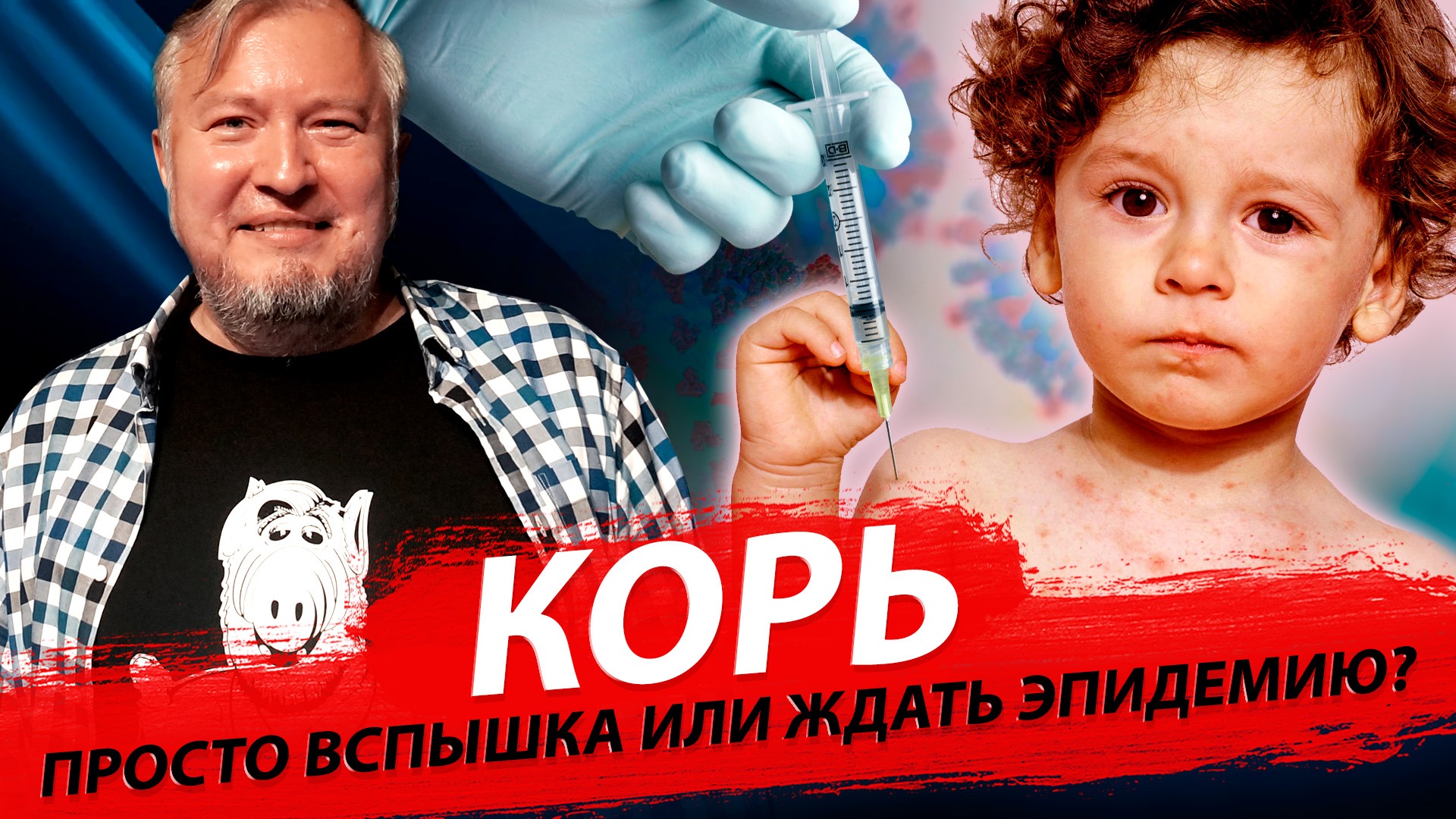 Корь вернулась? | Стрим ОТС LIVE – 28 февраля