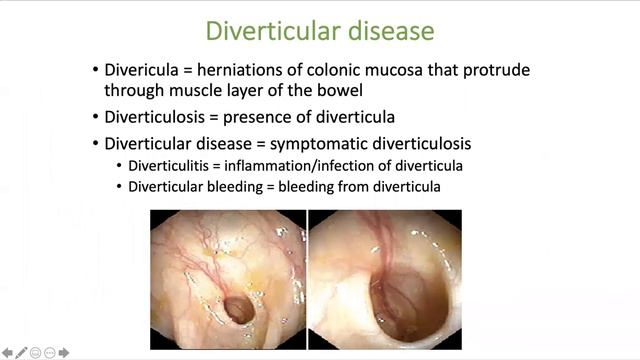 MUMUS Year 3 Revision Lectures: GIT Part 2 смотреть онлайн