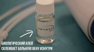 Лечение варикоза биоклеем VenaSeal