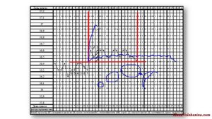 Нетипичные циклы. Лютеинизация фолликула. Урок 2-3.mp4