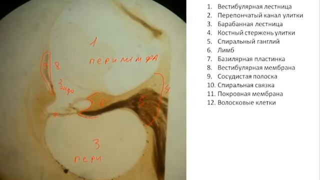 КОРТИЕВ ОРГАН | Разбор гистологического препарата