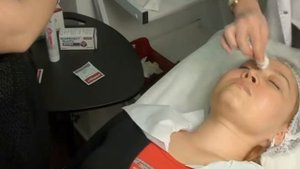 Чего не стоит бояться при пилинге  ТСА