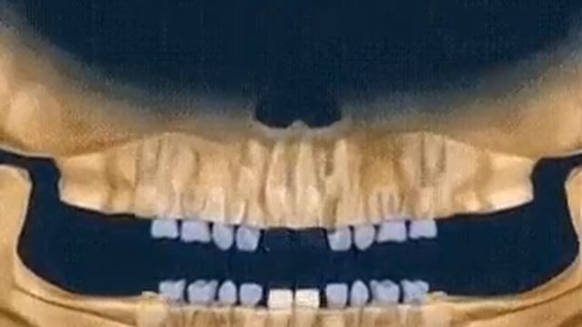 Прорезывание зубов смотреть онлайн