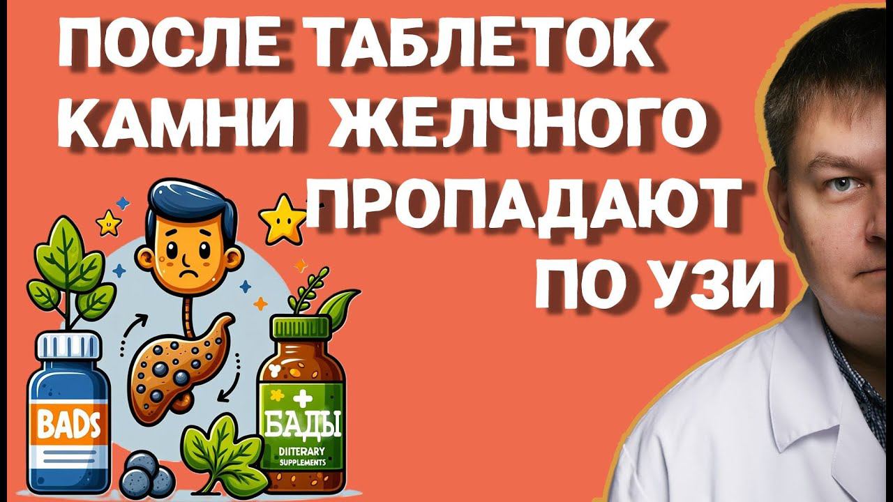 Удалять желчный или камни исчезнут от таблеток? Развенчиваю мифы о камнях в желчном!