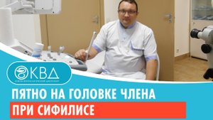 ? Пятно на головке члена при сифилисе. Клинический случай №363