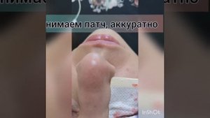 Снятие наращенных ресниц с помощью кремового ремувера