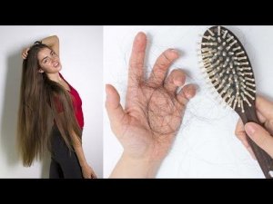 ПОЧЕМУ ВЫПАДАЮТ ВОЛОСЫ? 10 ОСНОВНЫХ ПРИЧИН ВЫПАДЕНИЯ ВОЛОС  POLI NA PALME