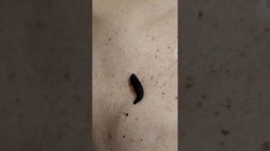 Лечение пиявками. Герудотерапия. Мой опыт, мои рекомендации.