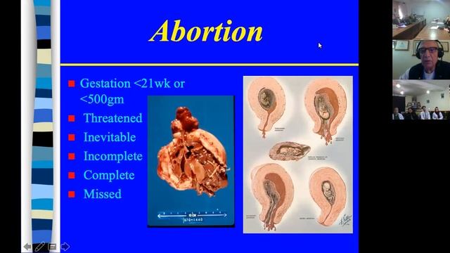 (2020-01-08) bleeding dilemma during pregnancy смотреть онлайн