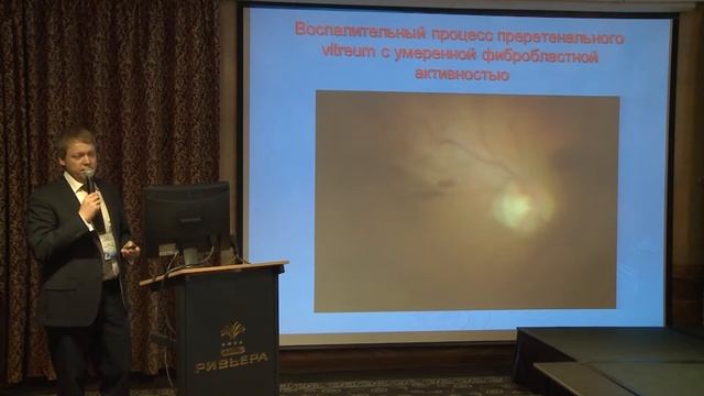 Виды эпиретинальных мембран. Клинические наблюдения. смотреть онлайн