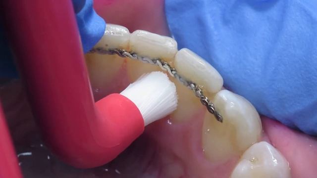 Tips & Tricks Πώς να χρησιμοποιείτε την TePe Compact Tuft (english) смотреть онлайн