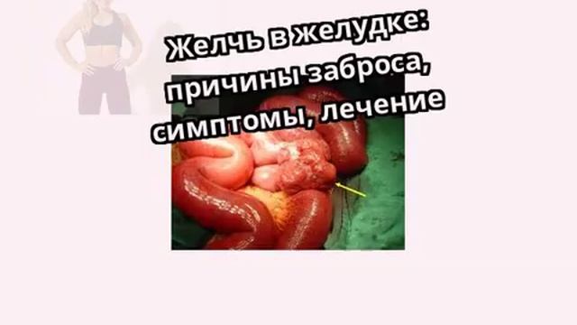 Желчь в желудке: причины заброса, симптомы, лечение