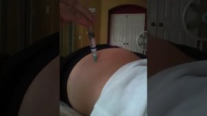 Bicillin Injection for Lyme Disease