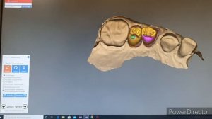 Моделирование коронок в дизайнерской 3D программе Exocad ?