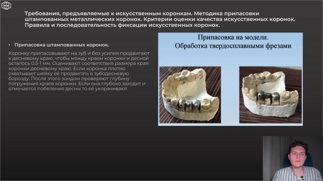 Зубопротезирование | ИСКУССТВЕННЫЕ КОРОНКИ смотреть онлайн