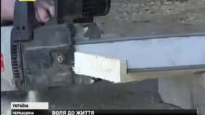 Мужчина родился без рук.