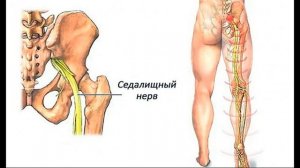 Хрен, картошка и мед от воспаления седалищного нерва.