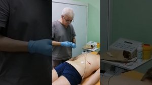 Электростимуляция противоболевая