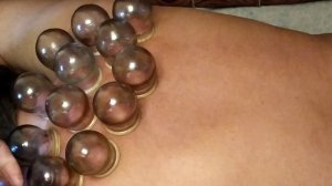 Мы ставим  банки