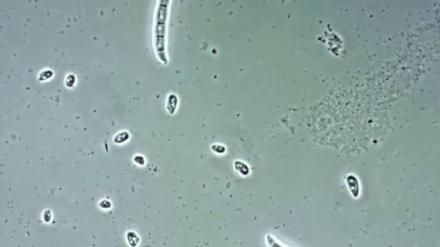 Конденсор K3PhZ и объектив Plan PH40 смотреть онлайн