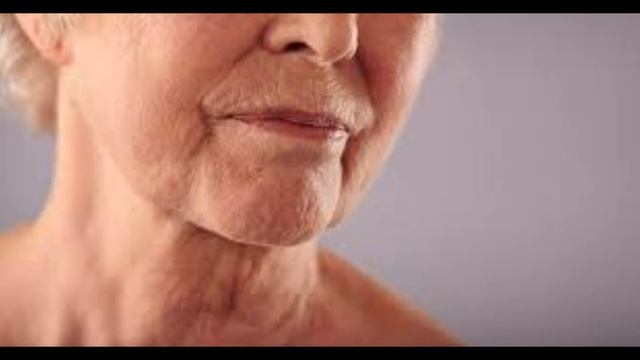 Каковы причины появления морщин. смотреть онлайн