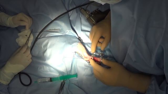 Атродез заплюсне-плюсневого сустава у кошки смотреть онлайн