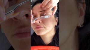 Изоляция нижних ресниц на сложных глазах?