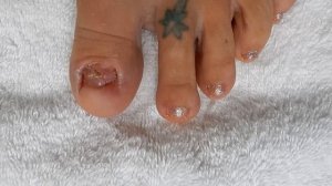 No TOENAILS / Make Some / Acrylic  Glitter Toesnails | Using Dual Forms