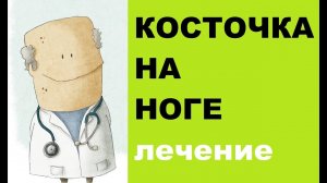 Как лечить косточку на ногах?