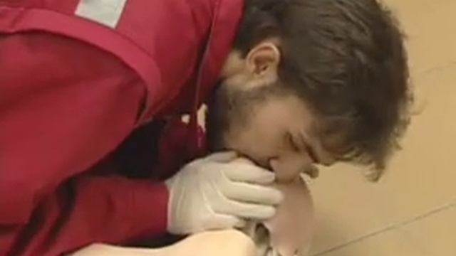 Искусственная вентиляция легких смотреть онлайн