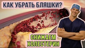 Как снизить ХОЛЕСТЕРИН? Бляшки в сосудах - как их почистить? Инфаркт, инсульт, кээ, стентирование