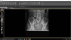 Viewing and basic tools of QxLink