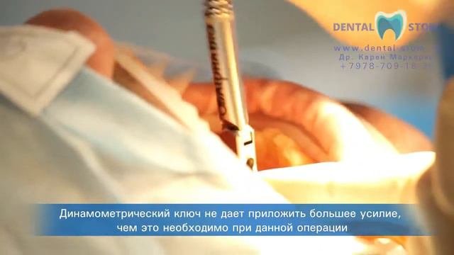 Имплантация зубов в Симферополе.