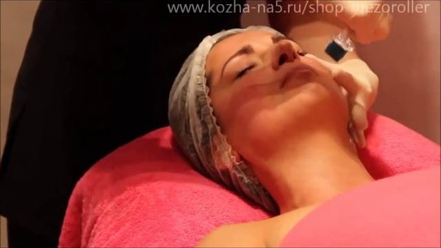 Мезороллер смотреть онлайн