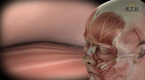 Эндоскопическая подтяжка лица: особенности проведения операции.