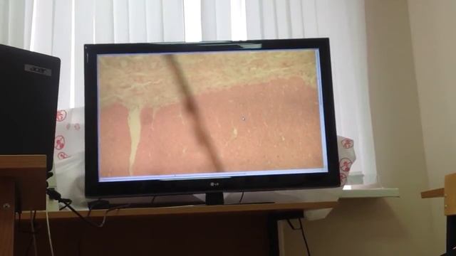 Гистология желудочно-кишечного тракта смотреть онлайн