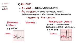 ECG Interpretation Made Easy (Learn How to Interpret an ECG in 13 Minutes)