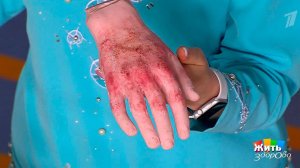 Не та грязь, что марает. Жить здорово! Фрагмент выпуска от 17.08.2017