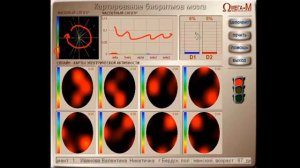 Расшифровка результатов диагностики на приборе "Омега". Олег Гончаренко