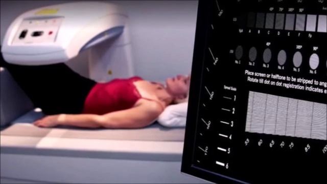 Денситометрия и остеопороз: ранняя диагностика коварной болезни