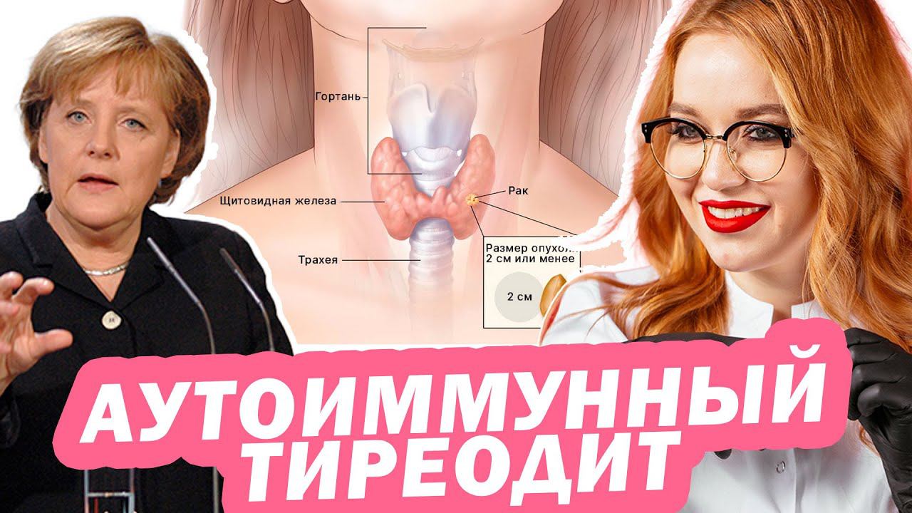 СЛОМАЛАСЬ ЩИТОВИДКА - АИТ / АУТОИММУННЫЙ ТИРЕОДИТ / ХАШИМОТО / ГИПОТЕРИОЗ