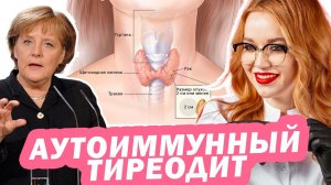 СЛОМАЛАСЬ ЩИТОВИДКА - АИТ / АУТОИММУННЫЙ ТИРЕОДИТ / ХАШИМОТО / ГИПОТЕРИОЗ