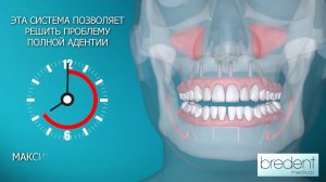 Система Fast & Fixed. Лечение беззубых челюстей за один день.