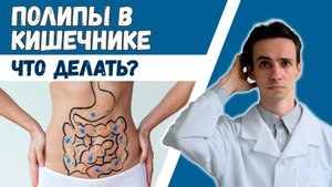 Полипы в кишечнике ? Опасны ли? Диагностика. Лечение. Профилактика