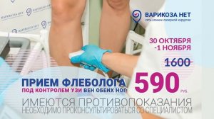 Варикоза нет. г. Уфа.
