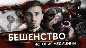 БЕШЕНСТВО - [История Медицины]