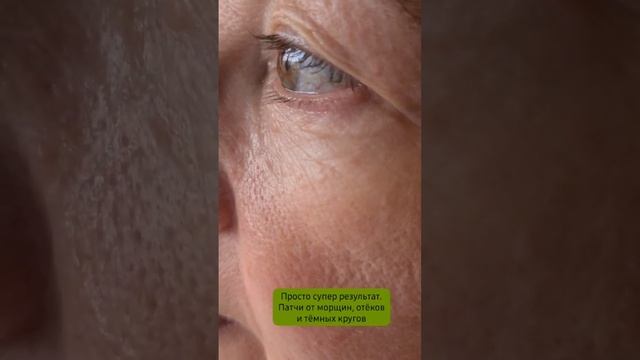 Натуральные патчи от морщин, отёков и тёмных кругов вокруг глаз, которые действительно работают! смотреть онлайн